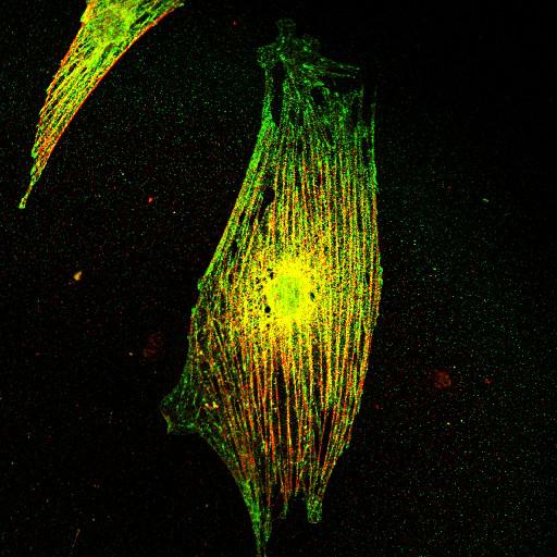  NCBI Organism:Mus musculus; Cell Types:fibroblast Cell Components:lamellipodium, myosin II complex, actin filament; Biological process:regulation of cell migration