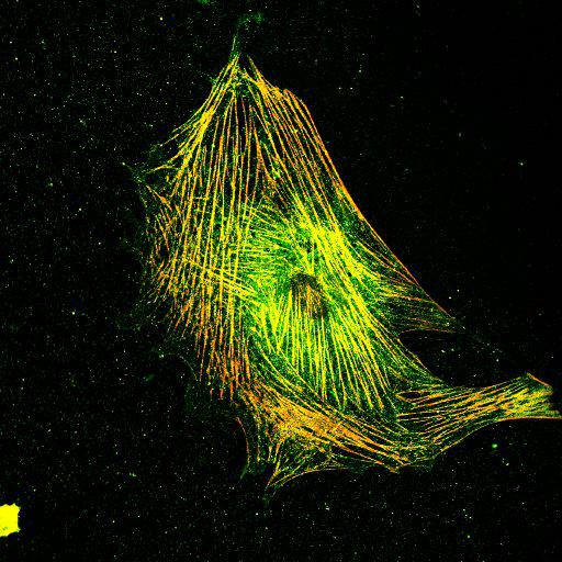  NCBI Organism:Mus musculus; Cell Types:fibroblast Cell Components:lamellipodium, myosin II complex, actin filament; Biological process:regulation of cell migration