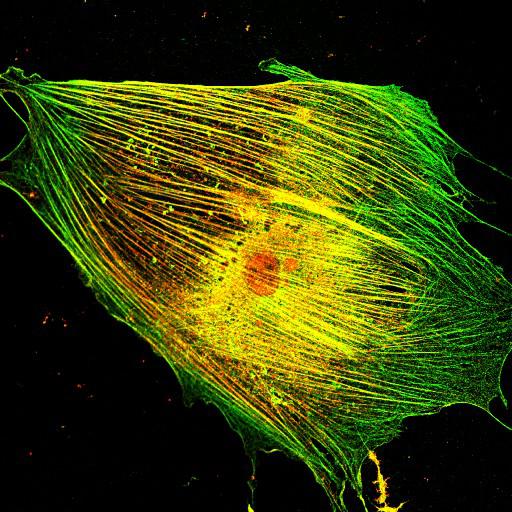  NCBI Organism:Mus musculus; Cell Types:fibroblast Cell Components:lamellipodium, myosin II complex, actin filament; Biological process:regulation of cell migration