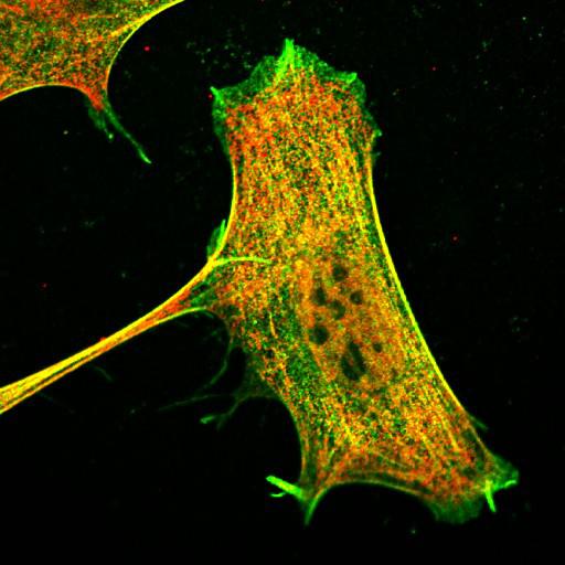  NCBI Organism:Mus musculus; Cell Types:fibroblast Cell Components:lamellipodium, myosin II complex, actin filament; Biological process:regulation of cell migration