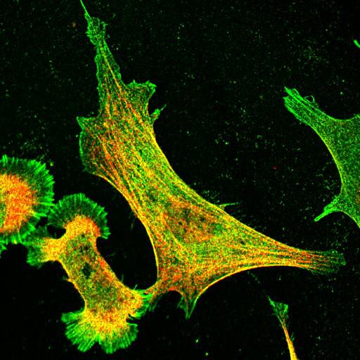  NCBI Organism:Mus musculus; Cell Types:fibroblast Cell Components:lamellipodium, myosin II complex, actin filament; Biological process:regulation of cell migration