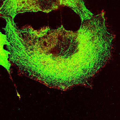  NCBI Organism:Mus musculus; Cell Types:fibroblast Cell Components:lamellipodium, myosin II complex, actin filament; Biological process:regulation of cell migration