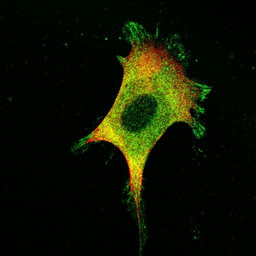  NCBI Organism:Mus musculus; Cell Types:fibroblast Cell Components:lamellipodium, myosin II complex, actin filament; Biological process:regulation of cell migration