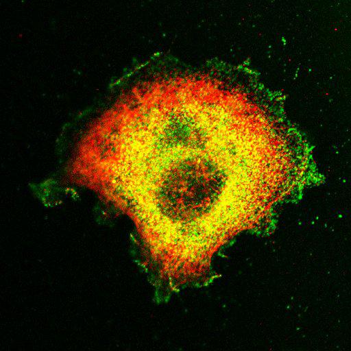  NCBI Organism:Mus musculus; Cell Types:fibroblast Cell Components:lamellipodium, myosin II complex, actin filament; Biological process:regulation of cell migration