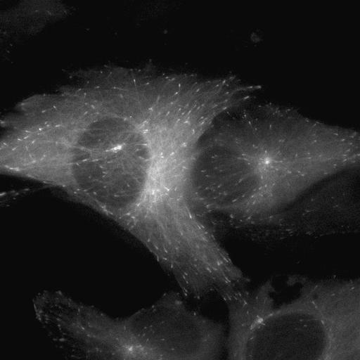  NCBI Organism:Homo sapiens; Cell Types:, epithelial cell; Cell Components:microtubule, cytoskeleton, microtubule plus end; Biological process:protein polymerization