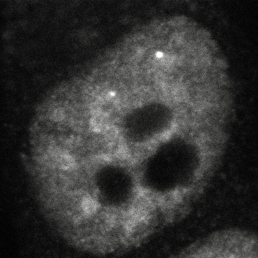  NCBI Organism:Homo sapiens; Cell Components:, , spliceosomal complex; Biological process:, RNA metabolic process;