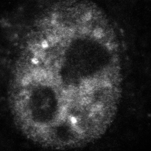  NCBI Organism:Homo sapiens; Cell Components:, , spliceosomal complex; Biological process:, RNA metabolic process;