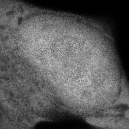  NCBI Organism:Homo sapiens; Cell Components:, , spliceosomal complex; Biological process:, RNA metabolic process;