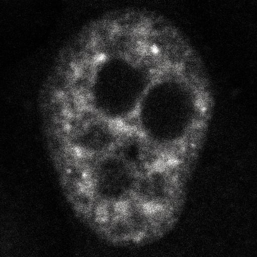  NCBI Organism:Homo sapiens; Cell Components:, , spliceosomal complex; Biological process:, RNA metabolic process;