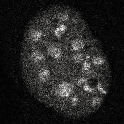  NCBI Organism:Homo sapiens; Cell Components:, , spliceosomal complex; Biological process:, RNA metabolic process;