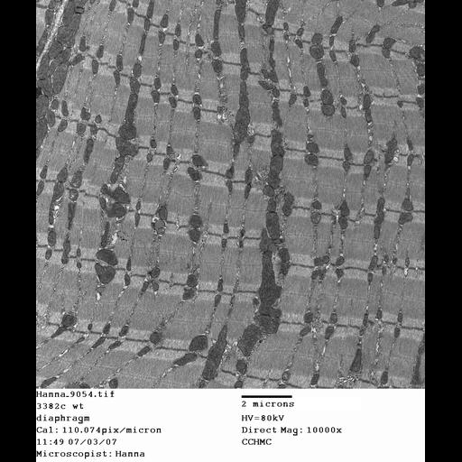  NCBI Organism:Mus musculus; Cell Types:skeletal muscle cell Cell Components:dystroglycan complex Biological process:plasma membrane organization