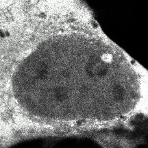  NCBI Organism:Homo sapiens; Cell Components:, , spliceosomal complex; Biological process:, RNA metabolic process;