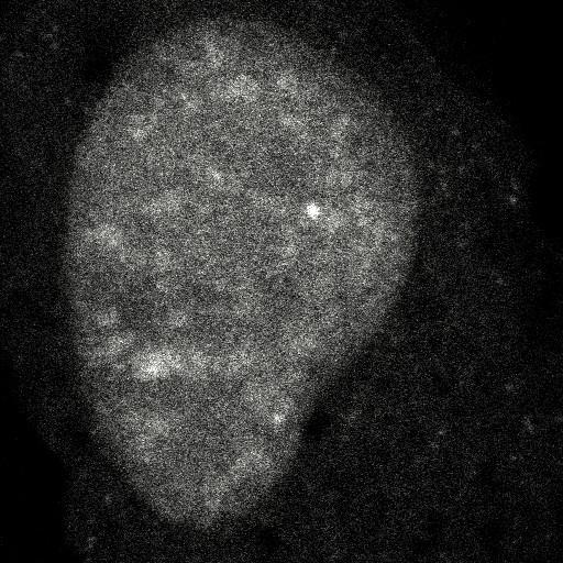  NCBI Organism:Homo sapiens; Cell Components:, , spliceosomal complex; Biological process:, RNA metabolic process;