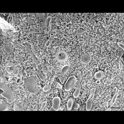  NCBI Organism:Paramecium multimicronucleatum; Cell Types:cell by organism, eukaryotic cell, , ; Cell Components:cytoplasm, early endosome, clathrin coat of endocytic vesicle, coated pit; Biological process:endosome organization, cytoplasm organization;