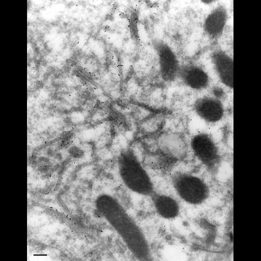  NCBI Organism:Paramecium multimicronucleatum; Cell Types:cell by organism, eukaryotic cell, , ; Cell Components:contractile vacuole, contractile vacuolar membrane, ; Biological process:contractile vacuole organization, ;