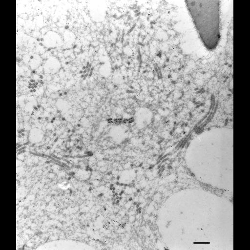  NCBI Organism:Paramecium multimicronucleatum; Cell Types:cell by organism, eukaryotic cell, , ; Cell Components:contractile vacuole, contractile vacuolar membrane, cytoplasmic microtubule; Biological process:contractile vacuole organization