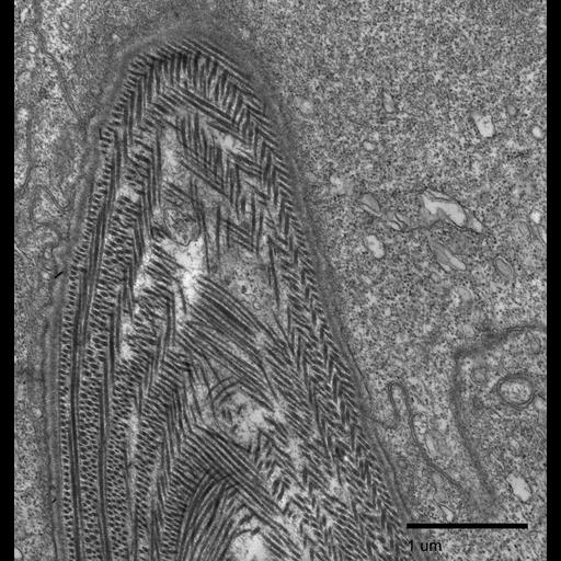  NCBI Organism:Fundulus heteroclitus; Cell Components:fibrillar collagen, , ; Biological process:extracellular matrix organization