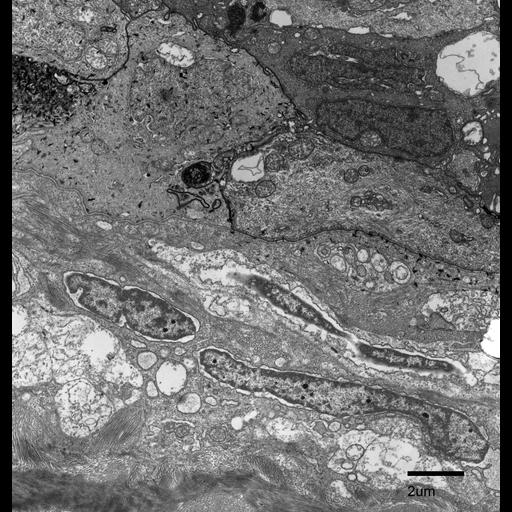  NCBI Organism:Fundulus heteroclitus; Cell Types:epidermal cell, fibroblast; Cell Components:collagen, basement membrane, ; Biological process:cytoskeleton organization