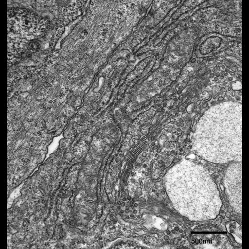  NCBI Organism:Fundulus heteroclitus; Cell Types:epidermal cell Cell Components:rough endoplasmic reticulum, Golgi apparatus, ribosome, mitochondrion, ; Biological process:cytoskeleton organization