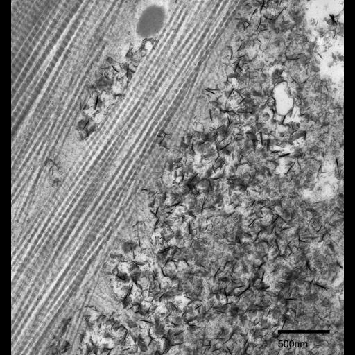  NCBI Organism:Fundulus heteroclitus; Cell Components:fibrillar collagen, ; Biological process:extracellular matrix organization