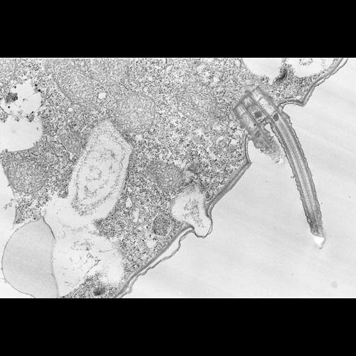  NCBI Organism:Colpoda cucullus; Cell Types:cell by organism, eukaryotic cell, , ; Cell Components:cilium, axoneme, microtubule basal body, , cell cortex; Biological process:cell motility