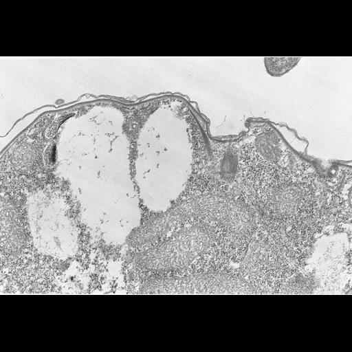  NCBI Organism:Colpoda cucullus; Cell Types:cell by organism, eukaryotic cell, , ; Cell Components:cell cortex, microtubule basal body, , ; Biological process:cortical cytoskeleton organization, cortical protein anchoring;