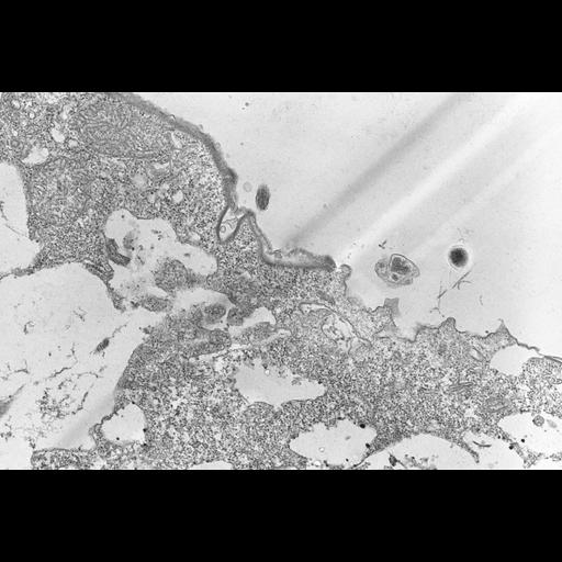  NCBI Organism:Colpoda cucullus; Cell Types:cell by organism, eukaryotic cell, , ; Cell Components:cell cortex, ; Biological process:cortical cytoskeleton organization, digestion, digestive system process;