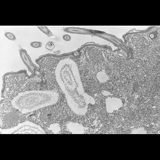  NCBI Organism:Colpoda cucullus; Cell Types:cell by organism, eukaryotic cell, , ; Cell Components:cilium, axoneme, microtubule basal body, , , cell cortex; Biological process:cell motility, cortical cytoskeleton organization;