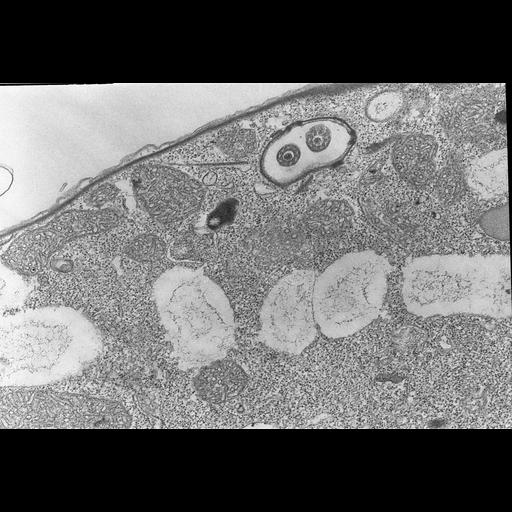  NCBI Organism:Colpoda cucullus; Cell Types:cell by organism, eukaryotic cell, , ; Cell Components:cilium, axoneme, microtubule basal body, cell cortex, , cytoplasm; Biological process:cell motility, cortical cytoskeleton organization, cytoplasm organization;