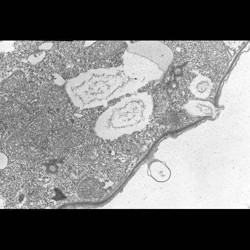  NCBI Organism:Colpoda cucullus; Cell Types:cell by organism, eukaryotic cell, , ; Cell Components:cilium, axoneme, microtubule basal body, , , cell cortex; Biological process:cell motility, cortical cytoskeleton organization;