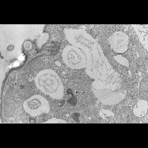  NCBI Organism:Colpoda cucullus; Cell Types:cell by organism, eukaryotic cell, , ; Cell Components:cilium, axoneme, microtubule basal body, , cell cortex, peroxisome; Biological process:cell motility, cortical cytoskeleton organization;