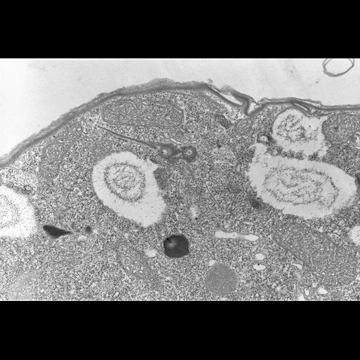  NCBI Organism:Colpoda cucullus; Cell Types:cell by organism, eukaryotic cell, , ; Cell Components:cilium, axoneme, microtubule basal body, , , cell cortex; Biological process:cell motility, cortical cytoskeleton organization;