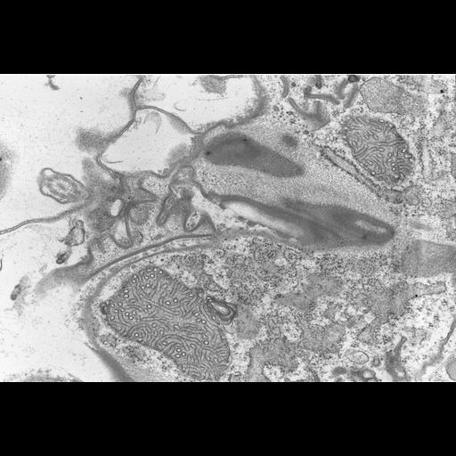  NCBI Organism:Coleps hirtus; Cell Types:eukaryotic cell, , ; Cell Components:cell cortex, rough endoplasmic reticulum, polysome, plasma membrane; Biological process:, vesicle targeting, rough ER to cis-Golgi;