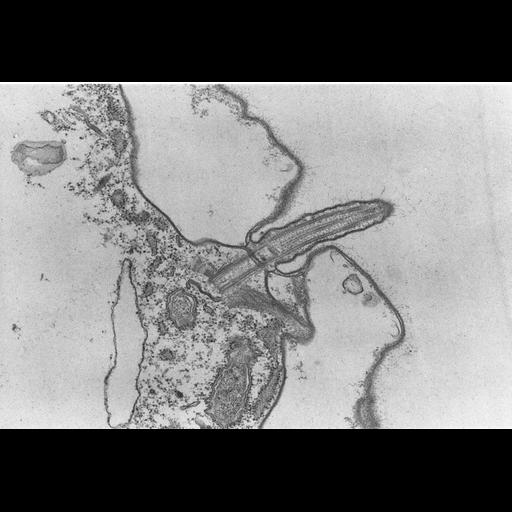  NCBI Organism:Coleps hirtus; Cell Types:eukaryotic cell, , ; Cell Components:cilium axoneme, axonemal microtubule, axonemal dynein complex, plasma membrane, microtubule basal body, cytoskeleton, microtubule cytoskeleton, actin cytoskeleton, bacteroid-containing symbiosome; Biological process:ciliary or flagellar motility, microtubule cytoskeleton organization, , detection of symbiont;