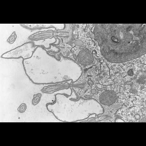  NCBI Organism:Coleps hirtus; Cell Types:eukaryotic cell, , ; Cell Components:cilium axoneme, axonemal microtubule, axonemal dynein complex, plasma membrane, microtubule basal body, cytoskeleton, microtubule cytoskeleton, actin cytoskeleton, food vacuole; Biological process:ciliary or flagellar motility, microtubule cytoskeleton organization, digestion;