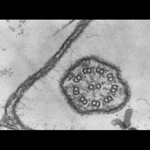  NCBI Organism:Coleps hirtus; Cell Types:eukaryotic cell, , ; Cell Components:cilium axoneme, axonemal microtubule, axonemal dynein complex, glycocalyx; Biological process:ciliary or flagellar motility, protein galactosylation at cell surface;