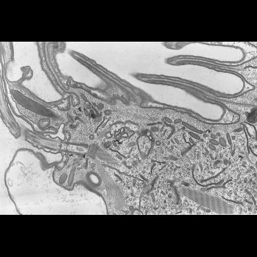  NCBI Organism:Coleps hirtus; Cell Types:eukaryotic cell, , ; Cell Components:cilium axoneme, axonemal microtubule, axonemal dynein complex, plasma membrane, microtubule basal body, cytoskeleton, microtubule cytoskeleton, actin cytoskeleton; Biological process:ciliary or flagellar motility, microtubule cytoskeleton organization, , ;