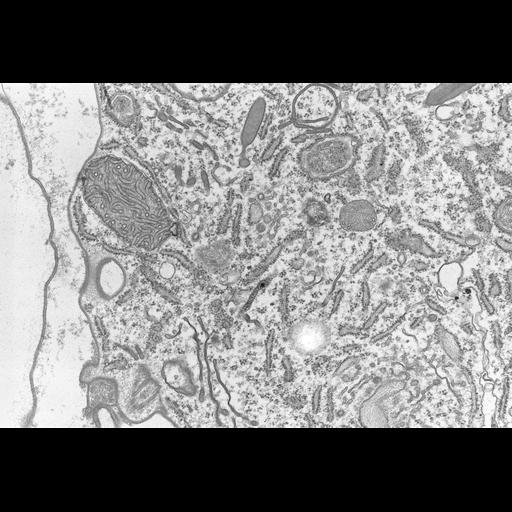  NCBI Organism:Coleps hirtus; Cell Types:eukaryotic cell, , ; Cell Components:rough endoplasmic reticulum membrane, smooth endoplasmic reticulum, mitochondrion, peroxisome, plasma membrane, , symbiont-containing vacuole, , ; Biological process:regulation of cellular metabolic process, , detection of symbiotic bacterium, , detection of symbiont;