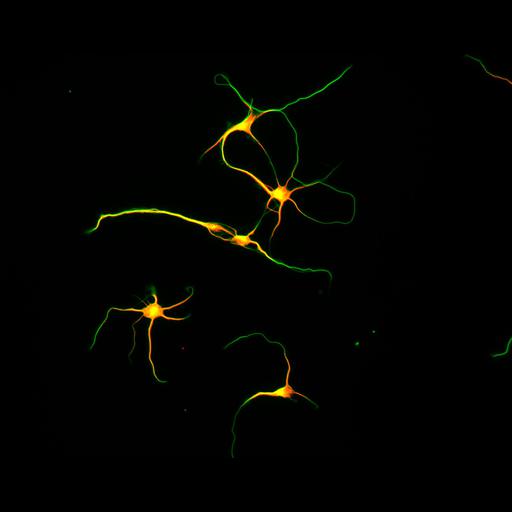  NCBI Organism:Rattus; Cell Types:multipolar neuron Cell Components:microtubule cytoskeleton, dendrite, axon; Biological process:dendrite development, establishment or maintenance of cell polarity;