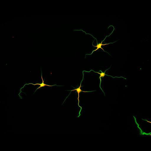  NCBI Organism:Rattus; Cell Types:multipolar neuron Cell Components:microtubule cytoskeleton, dendrite, axon; Biological process:dendrite development, establishment or maintenance of cell polarity;