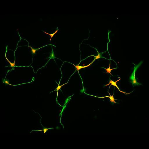  NCBI Organism:Rattus; Cell Types:multipolar neuron Cell Components:microtubule cytoskeleton, dendrite, axon; Biological process:dendrite development, establishment or maintenance of cell polarity;