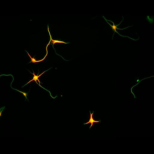  NCBI Organism:Rattus; Cell Types:multipolar neuron Cell Components:microtubule cytoskeleton, dendrite, axon; Biological process:dendrite development, establishment or maintenance of cell polarity;