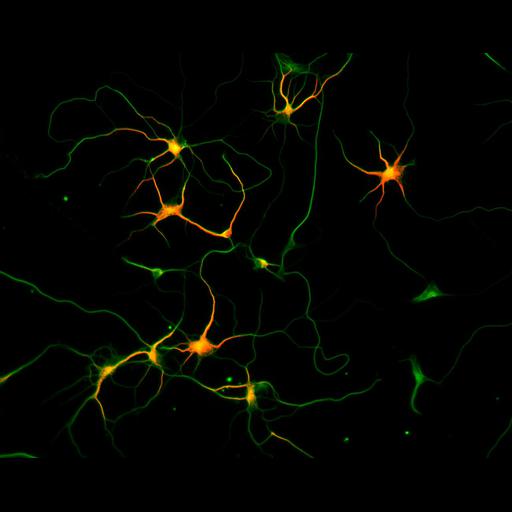  NCBI Organism:Rattus; Cell Types:multipolar neuron Cell Components:microtubule cytoskeleton, dendrite, axon; Biological process:dendrite development, establishment or maintenance of cell polarity;