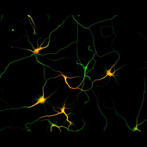  NCBI Organism:Rattus; Cell Types:multipolar neuron Cell Components:microtubule cytoskeleton, dendrite, axon; Biological process:dendrite development, establishment or maintenance of cell polarity;