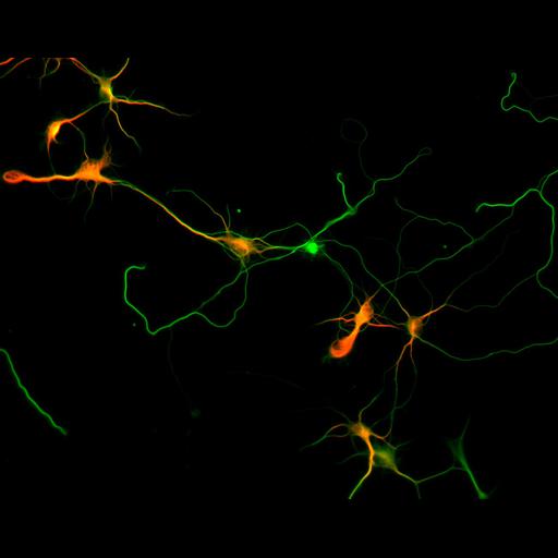  NCBI Organism:Rattus; Cell Types:multipolar neuron Cell Components:microtubule cytoskeleton, dendrite, axon; Biological process:dendrite development, establishment or maintenance of cell polarity;