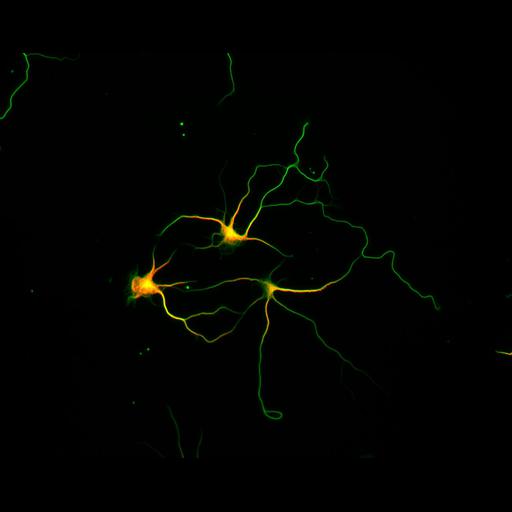  NCBI Organism:Rattus; Cell Types:multipolar neuron Cell Components:microtubule cytoskeleton, dendrite, axon; Biological process:dendrite development, establishment or maintenance of cell polarity;