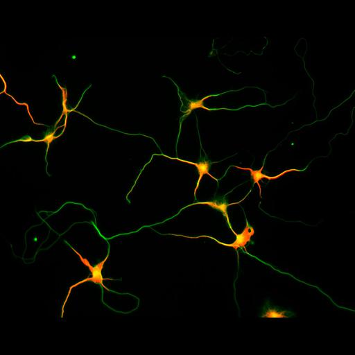  NCBI Organism:Rattus; Cell Types:multipolar neuron Cell Components:microtubule cytoskeleton, dendrite, axon; Biological process:dendrite development, establishment or maintenance of cell polarity;