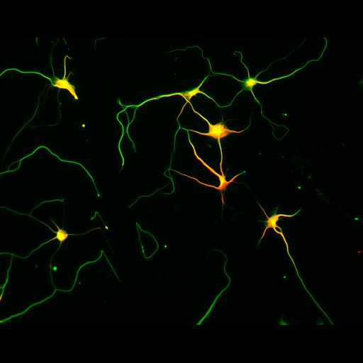  NCBI Organism:Rattus; Cell Types:multipolar neuron Cell Components:microtubule cytoskeleton, dendrite, axon; Biological process:dendrite development, establishment or maintenance of cell polarity;