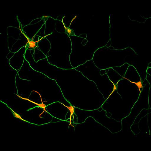  NCBI Organism:Rattus; Cell Types:multipolar neuron Cell Components:microtubule cytoskeleton, dendrite, axon; Biological process:dendrite development, establishment or maintenance of cell polarity;