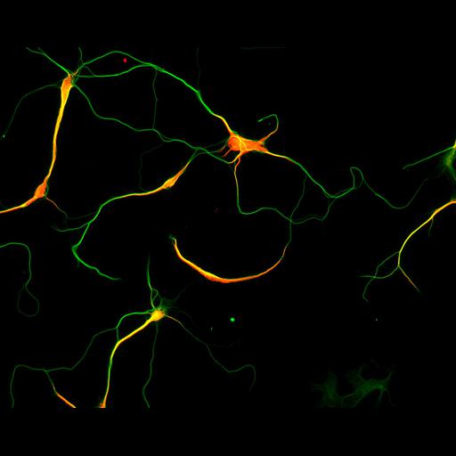  NCBI Organism:Rattus; Cell Types:multipolar neuron Cell Components:microtubule cytoskeleton, dendrite, axon; Biological process:dendrite development, establishment or maintenance of cell polarity;